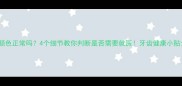 猫咪牙齿颜色正常吗4个细节教你判断是否需要就医牙齿健康小贴士大公开