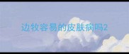 边牧容易的皮肤病吗