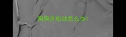 狗狗牙松动怎么办