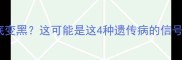 边境牧羊犬脚底变黑这可能是这4种遗传病的信号附护理指南