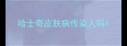 哈士奇皮肤病传染人吗