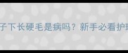 金毛幼犬脖子下长硬毛是病吗新手必看护理全攻略