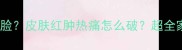 狗狗突然肿成包子脸皮肤红肿热痛怎么破超全家庭护理指南来了